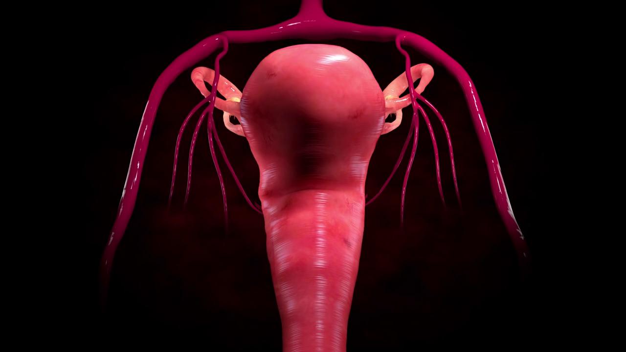 uterine artery embolization