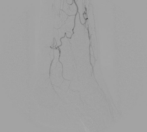 case1-image2 case1-image2