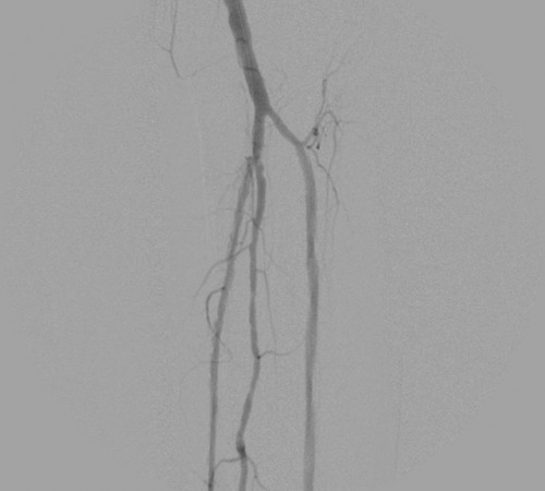 case1-image3 case1-image3