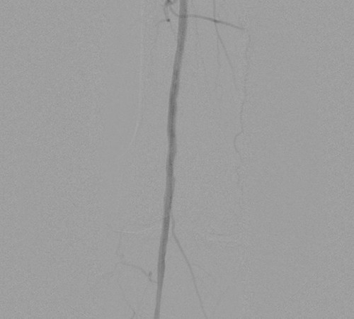 case2-image2 case2-image2