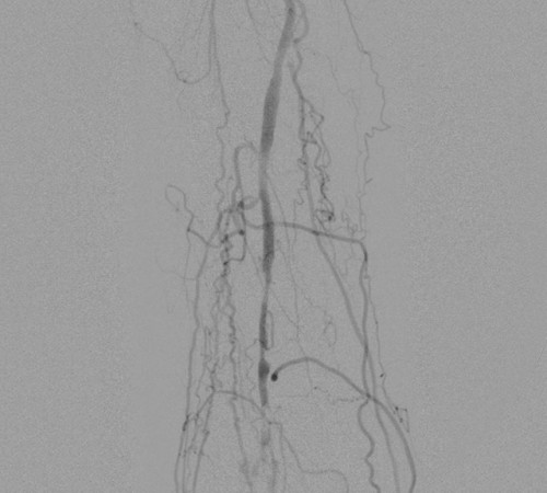 case2-image1 case2-image1