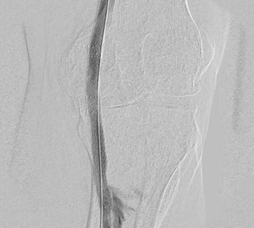 case4-image3 case4-image3
